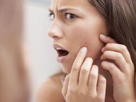 Smartphone là một trong những nguyên nhân hàng đầu huỷ hoại làn da của bạn